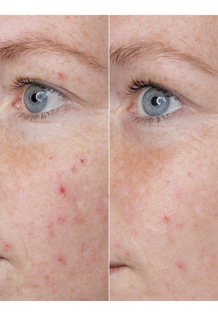 BABOR BABOR HYALURONIC ACID AMPOULE - Serum Online